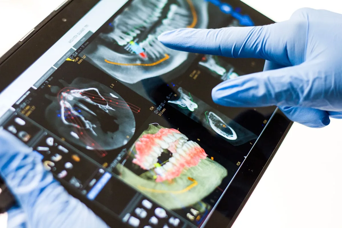 Digital Treatment Planning