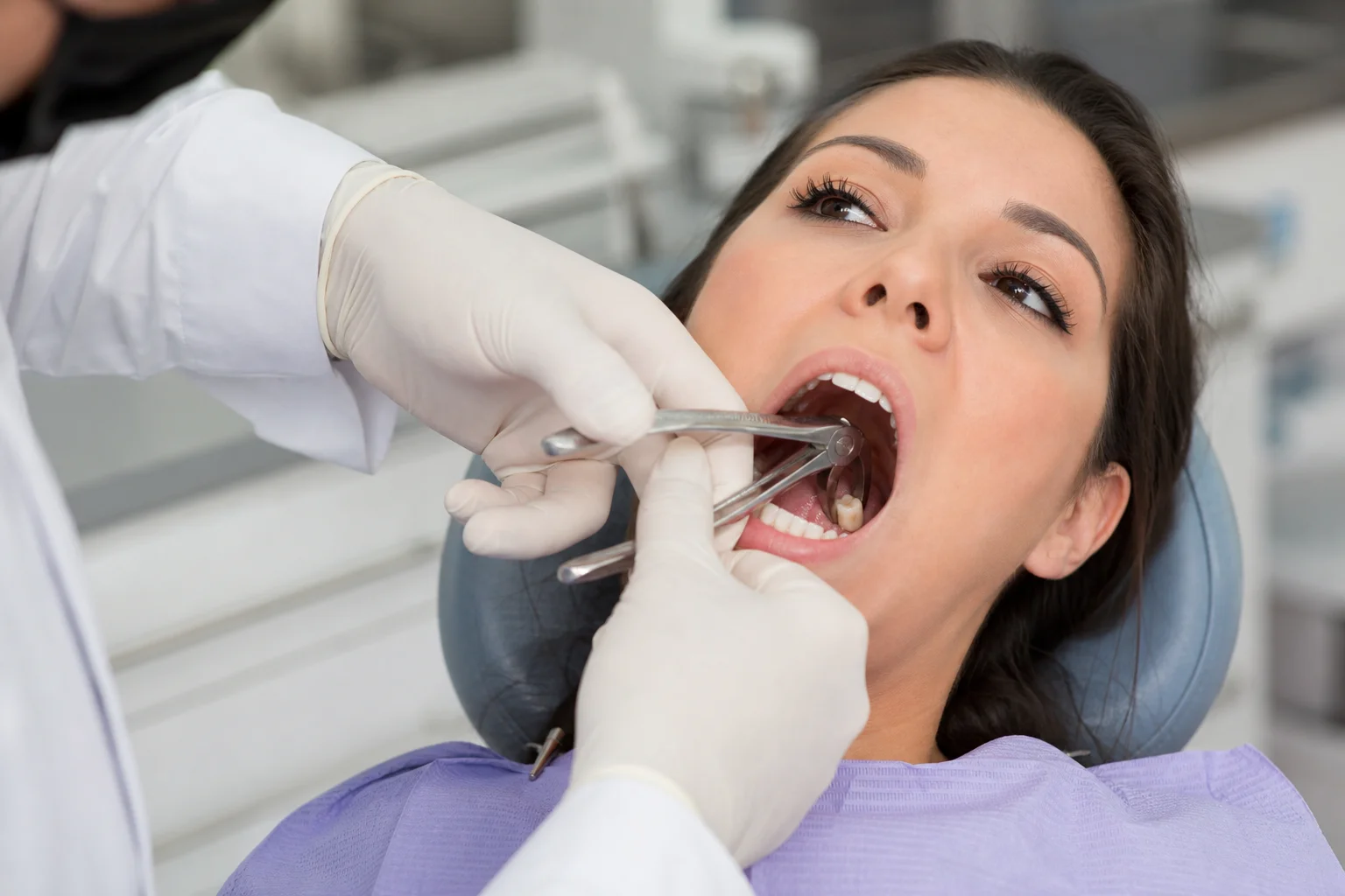 Tooth Extraction