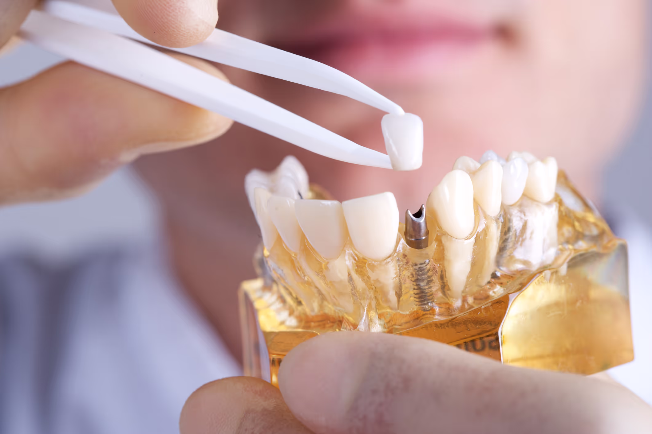 Perio Bright Dental Implant Center